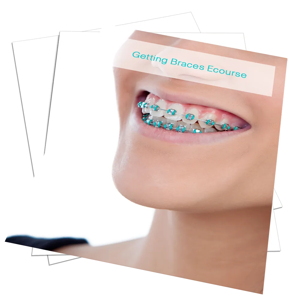 Getting Braces Ecourse